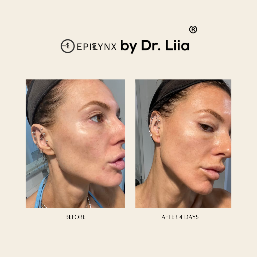 Epi Lynx - Face Serum